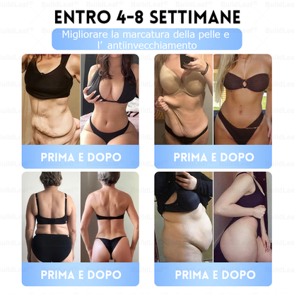 IT Clinicamente testato · Cerotto a microaghi nano BuildLeaf® Slim & Firm con Moringa, Omega-3, Peptidi di Collagene, NAD e NMN per obesità, salute cardiovascolare, diabete, apnea notturna, articolazioni, pelle e anti-età.
