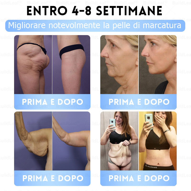 IT Clinicamente testato · Cerotto a microaghi nano BuildLeaf® Slim & Firm con Moringa, Omega-3, Peptidi di Collagene, NAD e NMN per obesità, salute cardiovascolare, diabete, apnea notturna, articolazioni, pelle e anti-età.