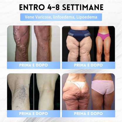 IT Clinicamente testato · Cerotto a microaghi nano BuildLeaf® Slim & Firm con Moringa, Omega-3, Peptidi di Collagene, NAD e NMN per obesità, salute cardiovascolare, diabete, apnea notturna, articolazioni, pelle e anti-età.